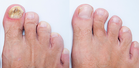 INFORMAZIONI DERMATOLOGICHE 