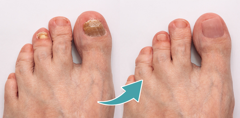 INFORMAZIONI DERMATOLOGICHE