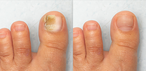 INFORMAZIONI DERMATOLOGICHE 