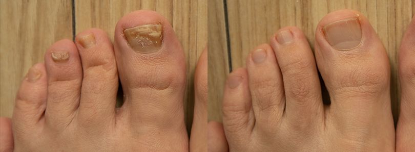INFORMAZIONI DERMATOLOGICHE