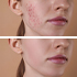 INFORMAZIONI DERMATOLOGICHE !