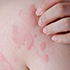 INFORMAZIONI DERMATOLOGICHE !