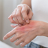 INFORMAZIONI DERMATOLOGICHE !